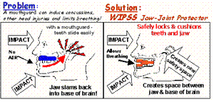Brain Pad *CLOSEOUT*